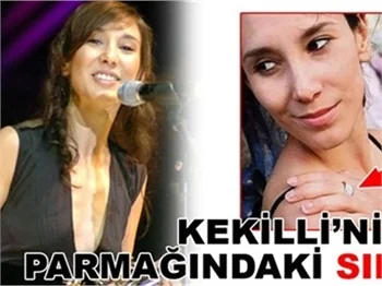 KEKİLİ'NİN PARMAĞINDAKİ SIR!