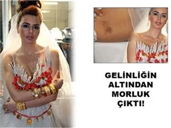 DAYAK MI ESTETİK Mİ?