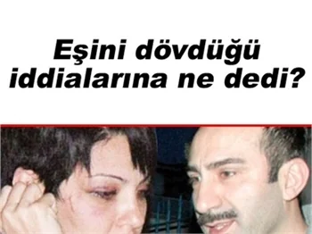 METİN YILDIZ'DAN 'DAYAK' HABERLERİNE AÇIKLAMA!