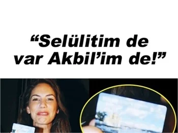 ZEYNEP BEŞERLER'İN YANITI ŞAŞIRTTI!