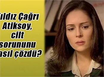 Yıldız Çağrı Atiksoy, cilt sorununu nasıl çözdü?