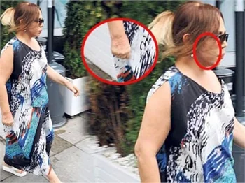 Sezen Aksu’nun hastalığı nüksetti!