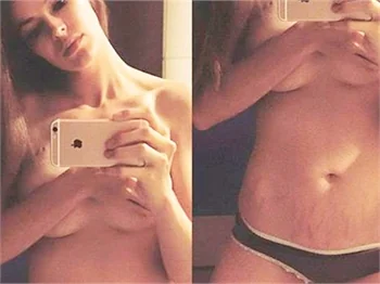 Robyn Lawley sosyal medyayı salladı!