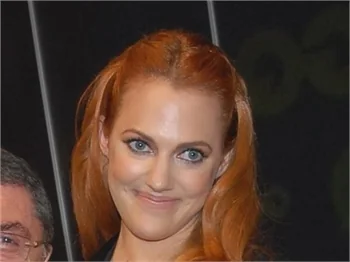 Meryem Uzerli'nin saçları yandı