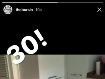 Serenay Sarıkaya'nın bacağına ne oldu?