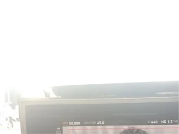 5 milyonluk reklam yıldızı!