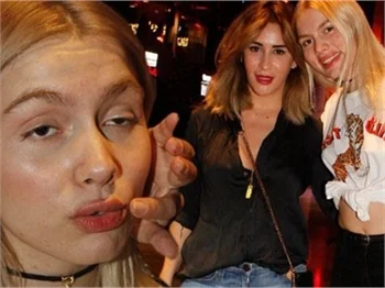 Aleyna Tilki'den estetik iddialarına yanıt!