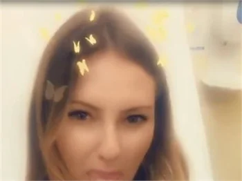 Serdar Ortaç'ın eşi Chloe Loughnan'dan aylar sonra ilk fotoğraf geldi!