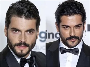 Akın Akınözü mü, Burak Özçivit mi?