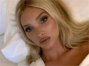 Elsa Hosk'tan şoke eden itiraf!