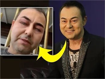 Serdar Ortaç'ın Instagram filtresiyle imtihanı!