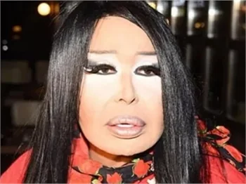 Bülent Ersoy'un durumu nasıl? Doktorundan açıklama geldi!