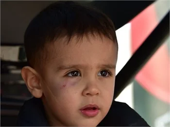 Burak’ın görünmez kazası! Alişan oğlu ve kızıyla görüntülendi
