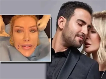 Seda Sayan, nikah öncesi 'deeplift' yaptırdı!